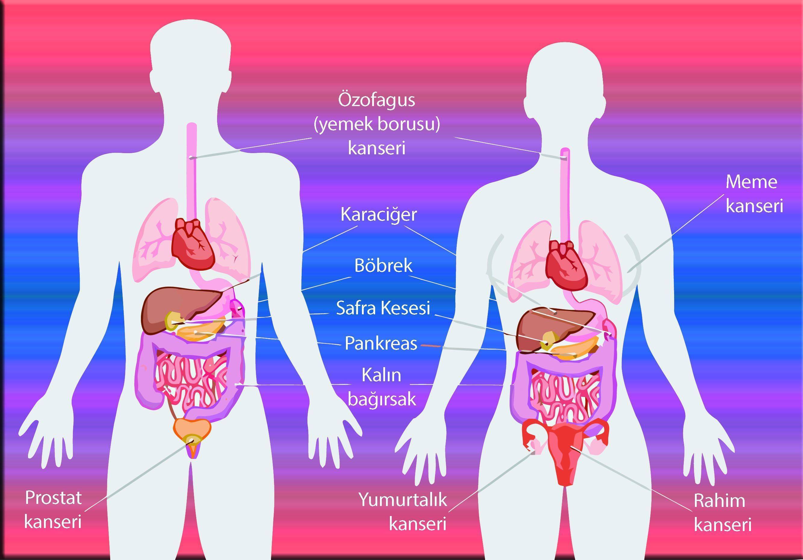 obezite ile iliskisi kanitlanmis kanserler 436741