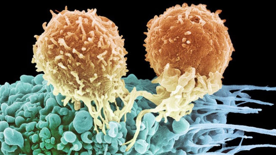 Was ist die Opdivo-(Nivolumab-)Immuntherapie? Bei welchen Krebsarten wirkt sie?