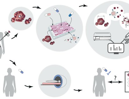 Organoid Modellerle Kişiye Özel Kanser Tedavisi – ESMO 2024'te Öne Çıkan Çalışma