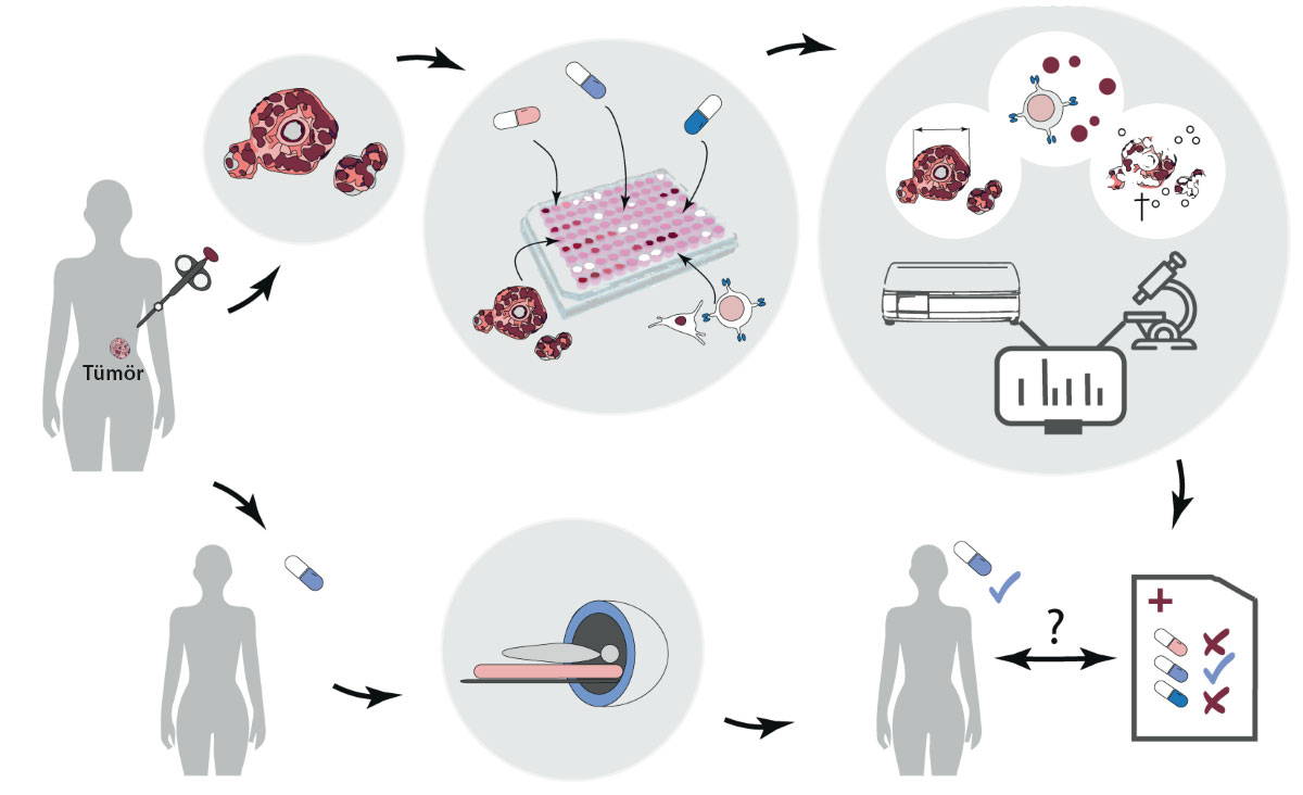 organoid modellerle kisiye ozel kanser tedavisi esmo 2024 one cikan calisma 424551