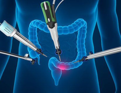 Is Robotic Surgery Superior in Rectal Cancer? Evaluating the Evidence from the REAL Trial
