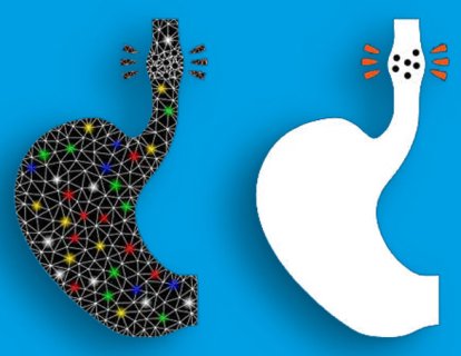 Orta Yaşta Özofagus (Yemek Borusu) Kanseri Görülme Sıklığında Belirgin Artış