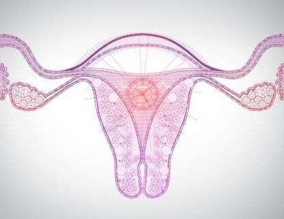 Over Kanseri Cerrahisinde Artık Tüm Taşlar Yerine Oturuyor