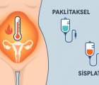 Over Kanserinde HİPEK: Karın İçi Sıcak Kemoterapide Paklitaksel mi, Sisplatin mi?