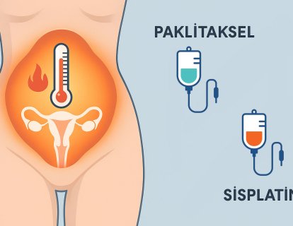Over Kanserinde HİPEK: Karın İçi Sıcak Kemoterapide Paklitaksel mi, Sisplatin mi?