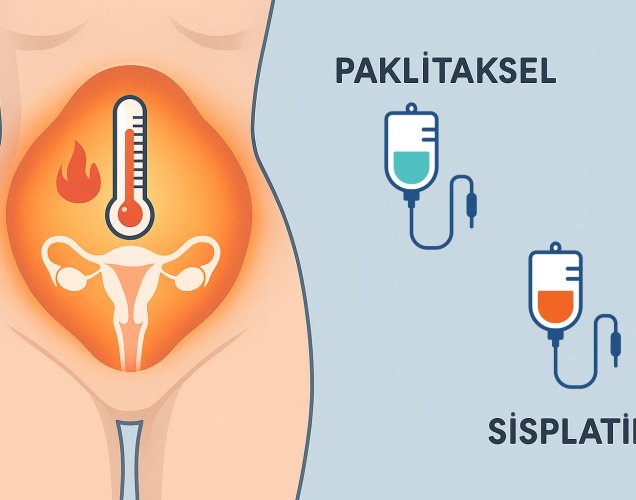 Over Kanserinde HİPEK: Karın İçi Sıcak Kemoterapide Paklitaksel mi, Sisplatin mi?