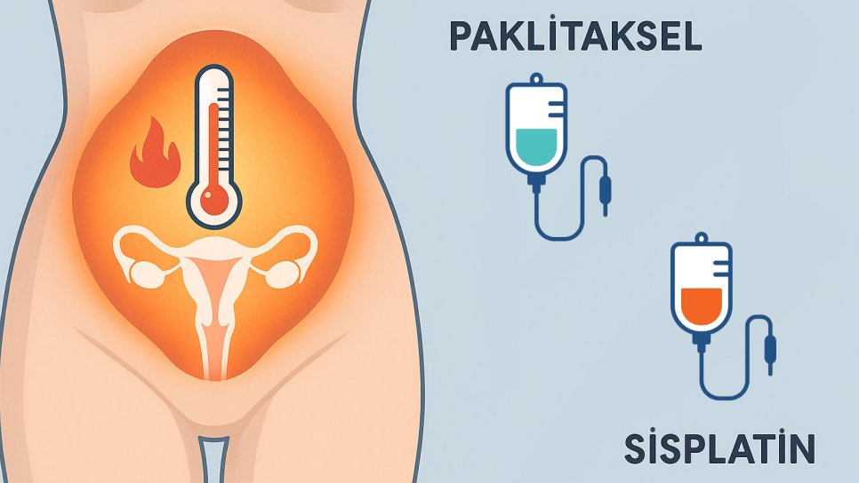 Over Kanserinde HİPEK: Karın İçi Sıcak Kemoterapide Paklitaksel mi, Sisplatin mi?