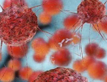 Over Kanserini Tespit Etmek için Yeni Bir Görüntüleme İlacı FDA Onayı Aldı