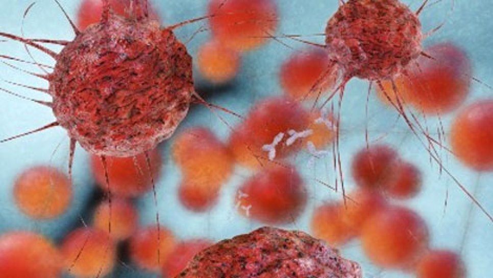 Over Kanserini Tespit Etmek için Yeni Bir Görüntüleme İlacı FDA Onayı Aldı