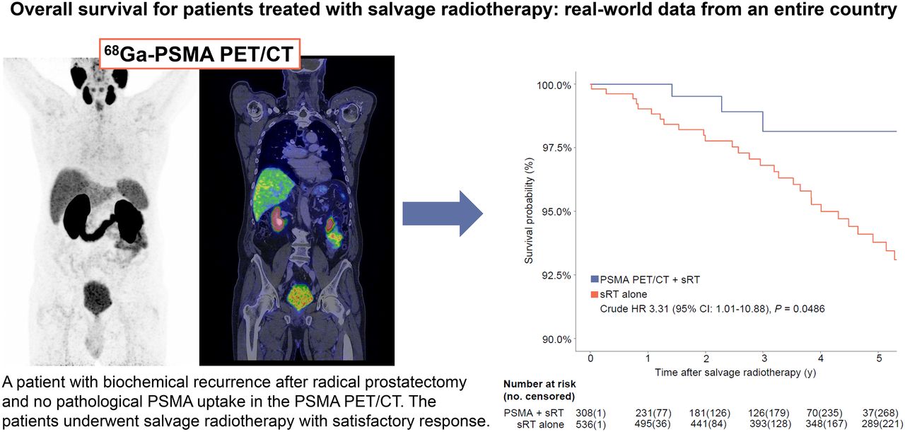 overall survival in patients treated with salvage radiotherapy real life data covering the entire c