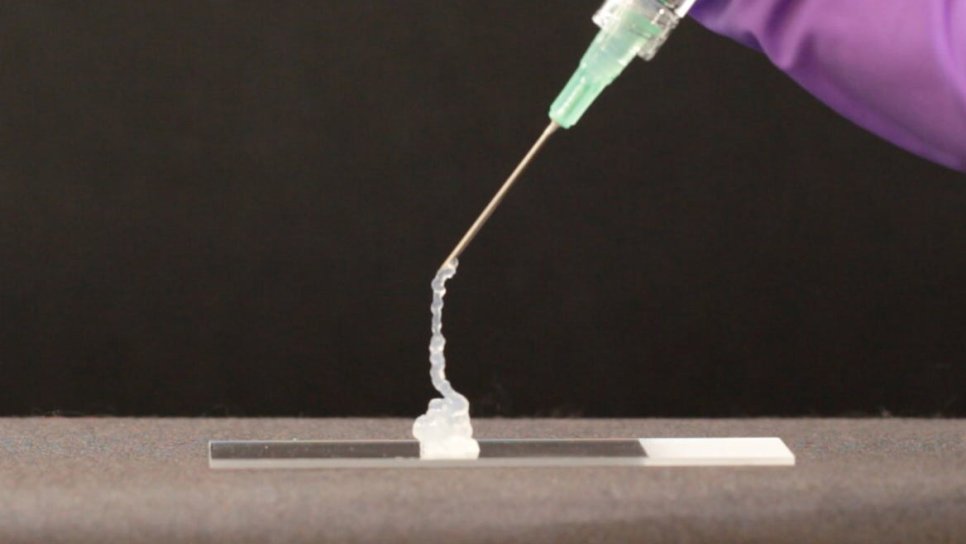 CAR-T-Zellen in einem speziellen Gel könnten die Krebsbehandlung verändern