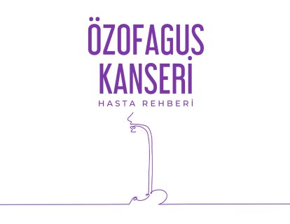 Özofagus (Yemek Borusu) Kanseri Belirtileri, Evreleri ve Tedavisi – Hasta Rehberi