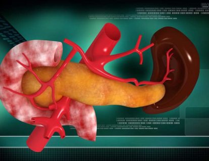 İlk kez pankreas kanseri tedavisi için bir akıllı ilaç onaylandı