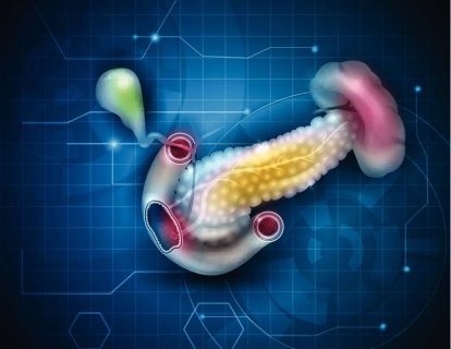 Pankreas kanseri tedavisinde son gelişmeler