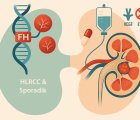 Papiller Böbrek Kanserinde Yenilik: Kalıtsal ve Sporadik Hastalarda Bevasizumab-Erlotinib