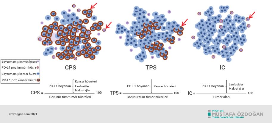 pd l1 olcum ycntemlerinin karsilastirilmasi cps tps ic tc 945907