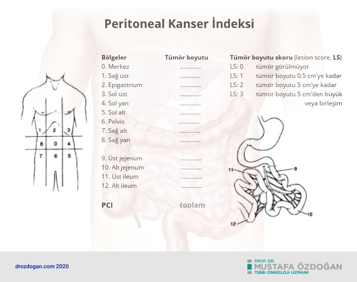 peritoneal kanser indeksi nedir 204951