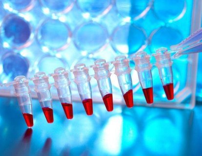 Polimeraz Zincir Reaksiyonu Nedir? PCR Tarihçesi, Nasıl Yapılır ve Tıbbi Önemi