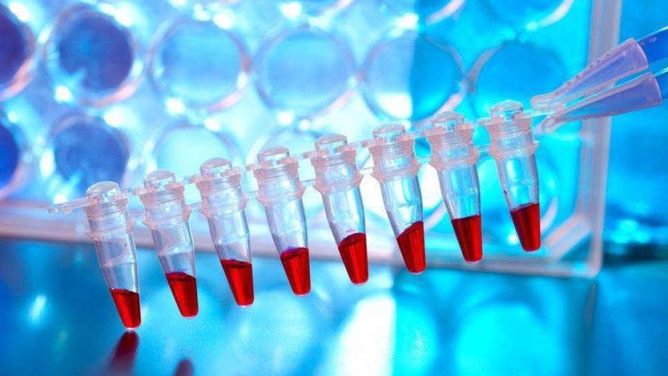 Polimeraz zincir reaksiyonu nedir? PCR tarihçesi, nasıl yapılır ve tıbbi önemi