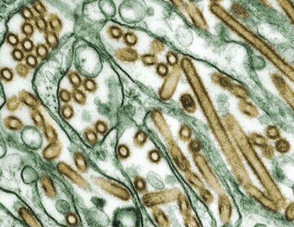 Probiyotiklerin keşfi ve sağlıktaki yeri – Yalan mı gerçek mi?