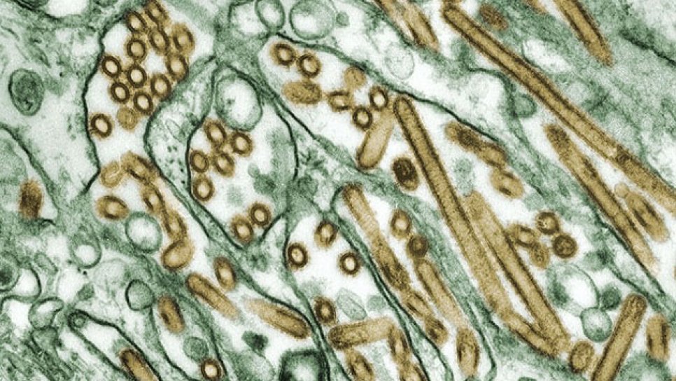 Probiyotiklerin keşfi ve sağlıktaki yeri – Yalan mı gerçek mi?