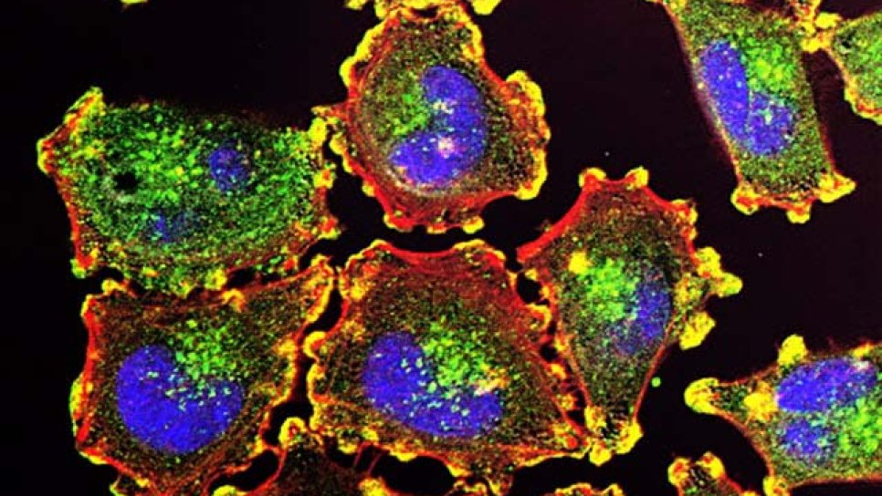A New Approach to Cancer Treatment Through Programmed Cell Death (Apoptosis)