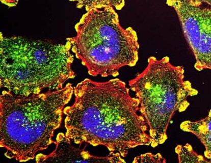 Programlı hücre ölümü (apoptoz) üzerinden kanser tedavisine yeni bir soluk