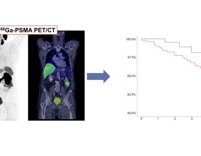 Life-Saving Role of PSMA PET/CT in Treating Biochemical Recurrence of Prostate Cancer