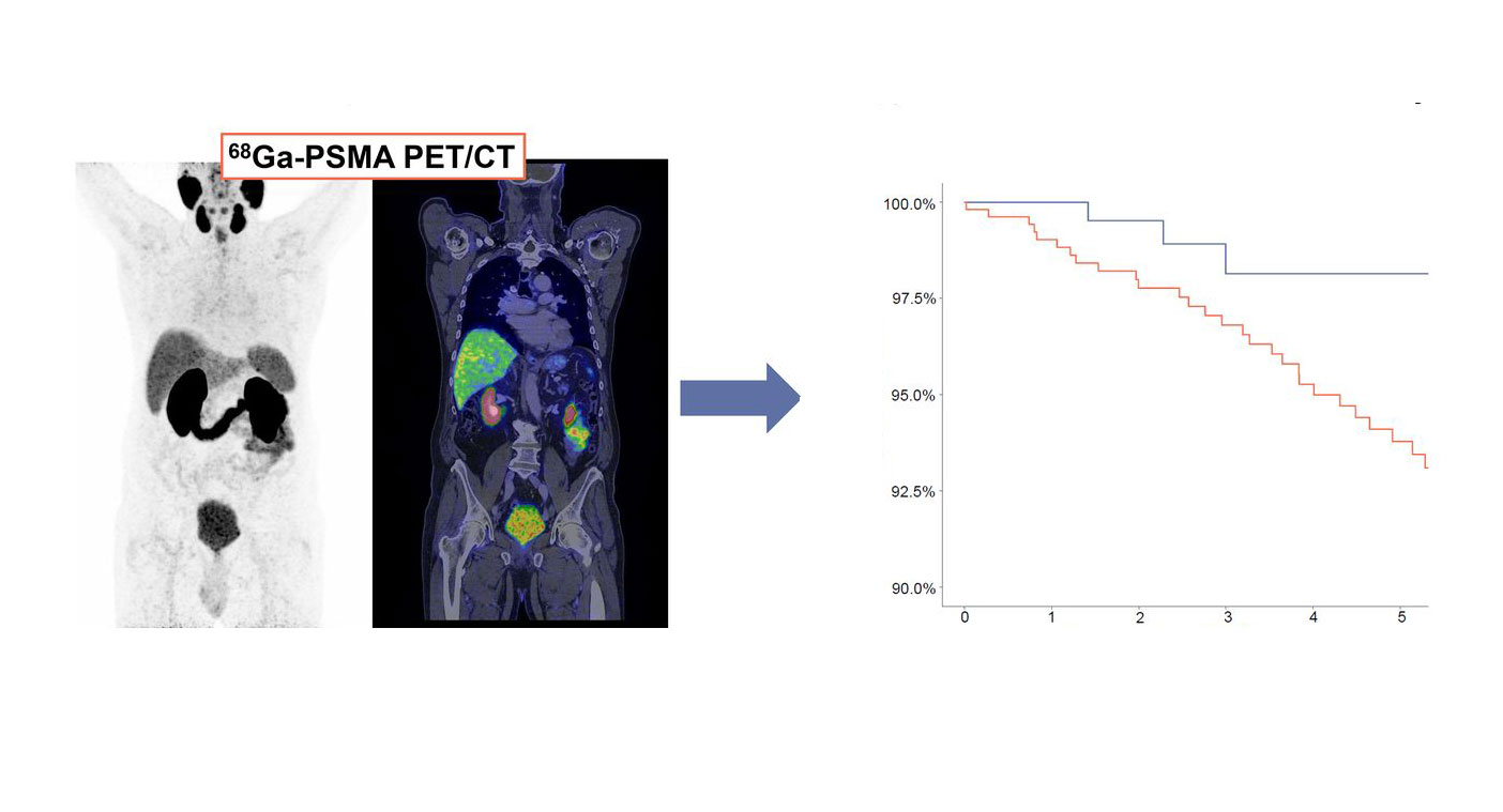 Life-Saving Role of PSMA PET/CT in Treating Biochemical Recurrence of ...