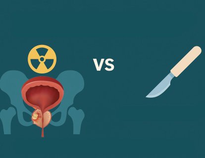 Prostat Kanserinde Cerrahi mi, Radyoterapi mi? Tartışma Bitiyor mu?