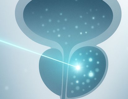 PSMAddition: Lutesyum Birinci Basamakta Umut Veriyor, Ama Veriler Henüz Olgun Değil