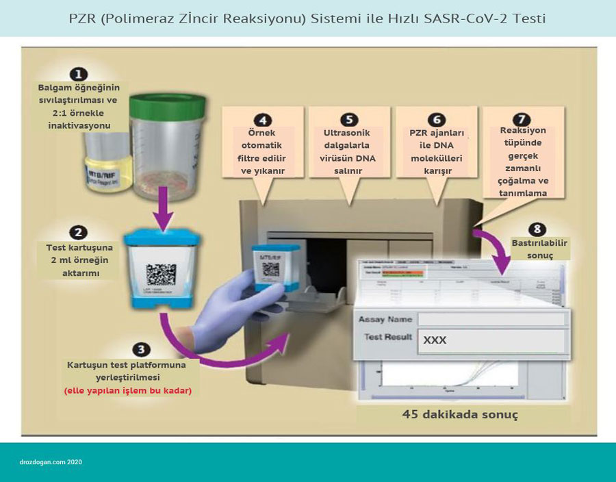 Schneller SARS CoV 2-Test mit dem PZR-Polymerase-Kettenreaktionssystem