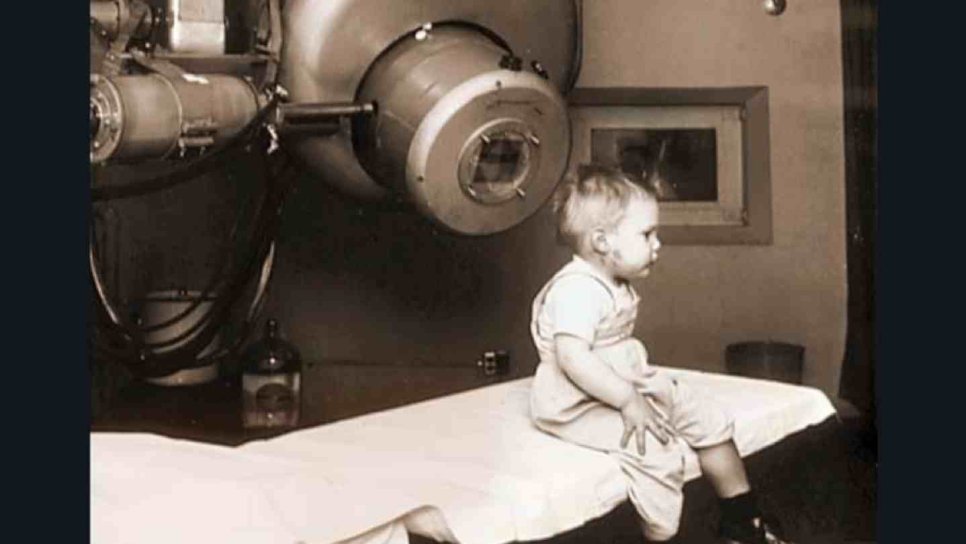 Strahlentherapie 1903 – Radiotherapie, „Şua“ oder Bestrahlung