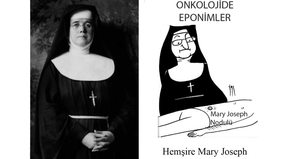 Rahibe Mary Joseph Nodülü Nedir Adı Nereden Gelmektedir