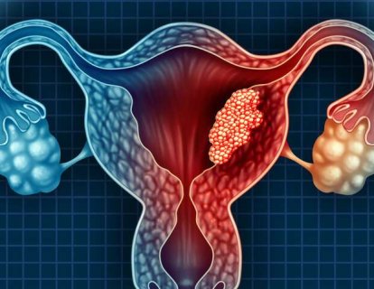 Rahim kanseri tedavisinde bir ilk: immünoterapi ve akıllı ilaç kombinasyonu FDA onayı aldı