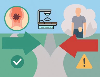 Rektum Kanserinde Ameliyat Öncesi Radyoterapi: Kime Fayda Sağlıyor, Kime Zarar Veriyor?