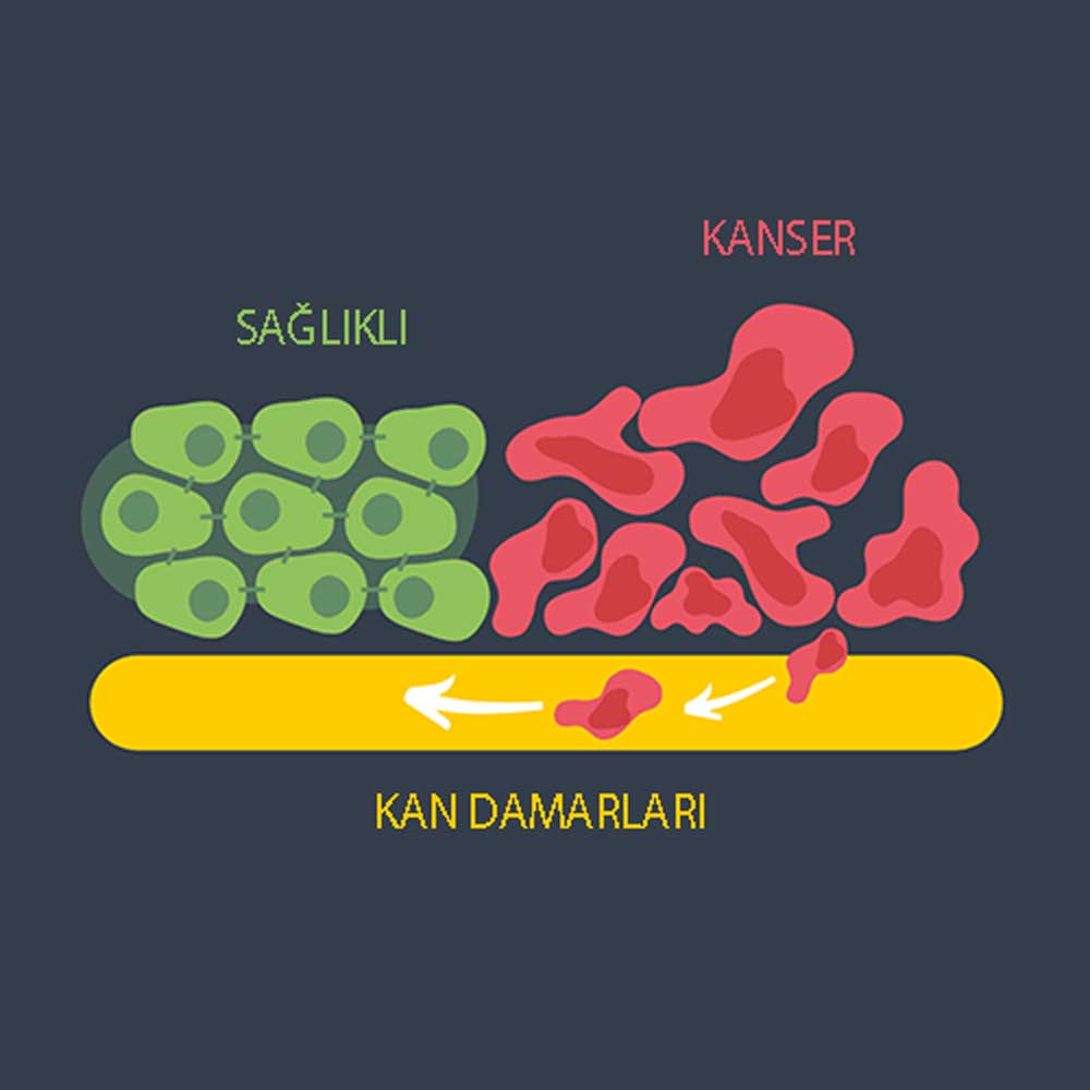 sağlam hüceyrələr bir-birinə yapışır xərçəng hüceyrələri isə DNA mutasiyaları səbəbindən qonşu hüceyrələrə bağlana bilmir bu onların qan dövranına keçməsini və bədənə yayılmasını asanlaşdırır