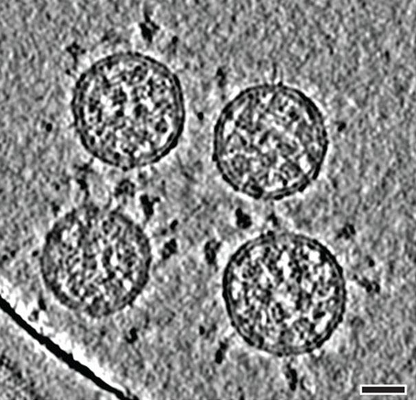 Kryoelektronentomografische Aufnahmen von SARS-CoV-2