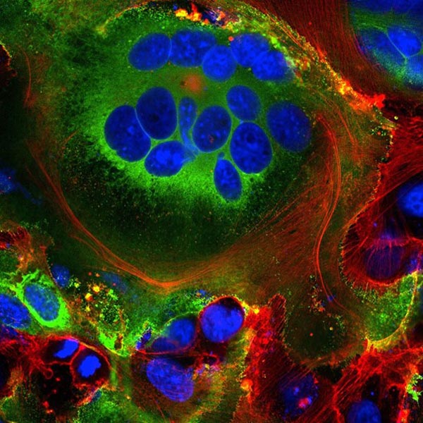 Verschmolzene Zellstrukturen in Zellen, die das SARS-CoV-2-Spike-Protein exprimieren; Zellkerne blau und Zellskelett rot
