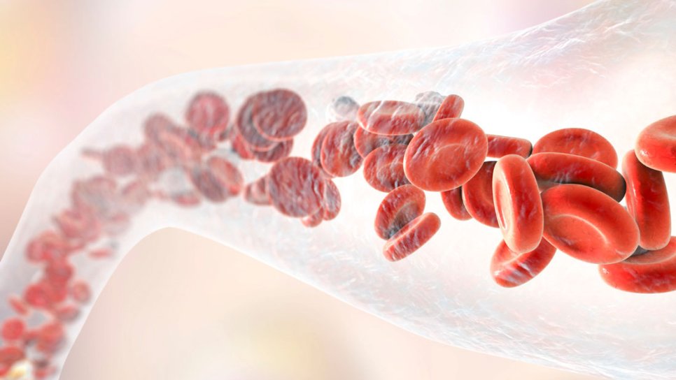Şiddetli Hemofili A Olan Yetişkinler için İlk Gen Tedavisi FDA Onayı Aldı: Roctavian