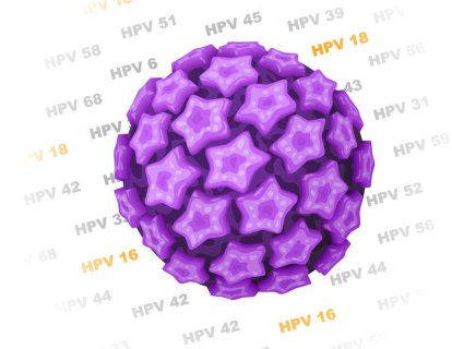 Solunum papillomatozu ve tonsil kanseri – HPV ilişkili iki hasta örneği