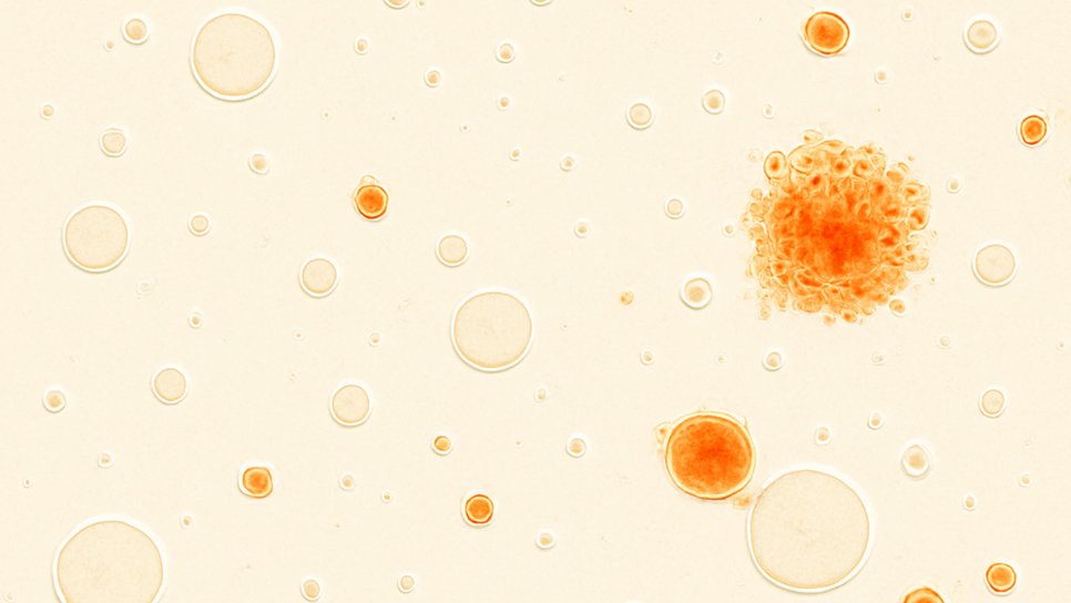Giving T Cells a GPS: How Do AI-Designed Proteins Target Cancer?