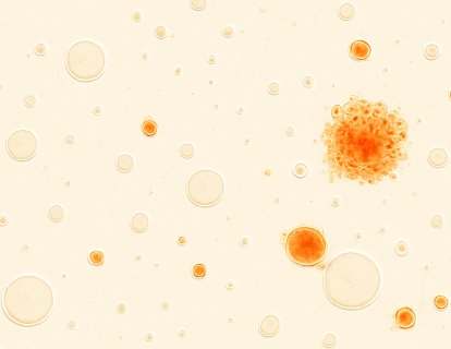 T Hücrelerine GPS Takmak: Yapay Zeka ile Tasarlanan Proteinler Kanseri Nasıl Hedefliyor?