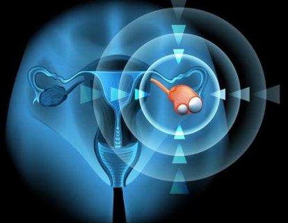 Pudra, Over (Yumurtalık) Kanseri Gelişiminde Nasıl Bir Rol Oynuyor?