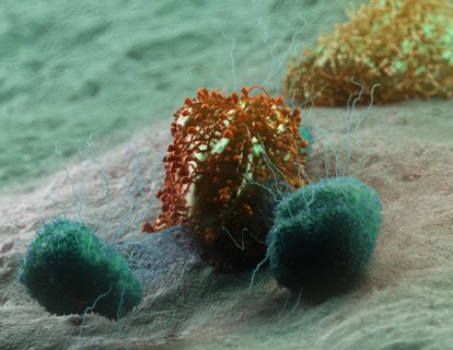 Atezolizumab (Tecentriq) Nedir? FDA Onayı, Türkiye Ruhsatı ve Geri Ödeme Durumu