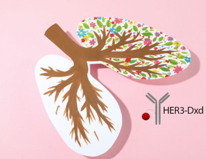 Tedaviye Dirençli EGFR-Mutant Akciğer Kanserinde HER3 Hedefli Patritumab Deruxtecan