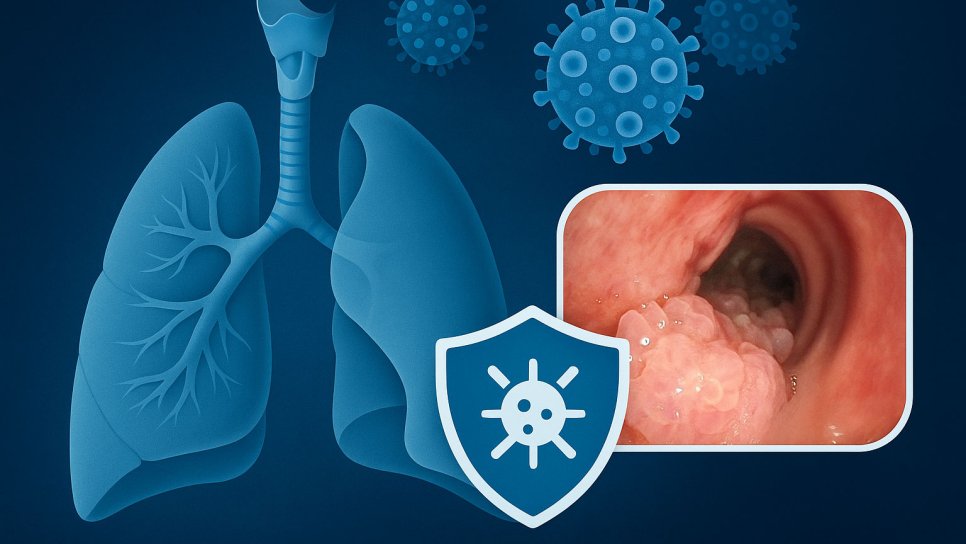 نخستین ایمنی‌درمانی برای پاپیلوماتوز تنفسی عودکننده: Papzimeos تأیید FDA را دریافت کرد