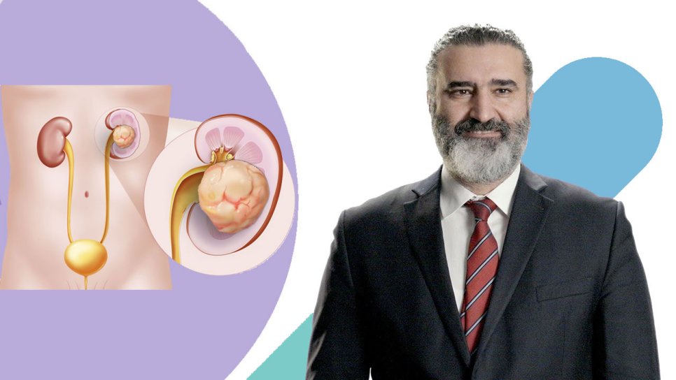 Онколог, профессор Yüksel Ürün рассказывает о карьере и балансе работы и личной жизни