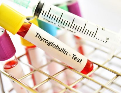 Tiroglobulin ve TgAb Testi Nedir? Yüksekliği Neden Olur? Kanserle İlişkisi