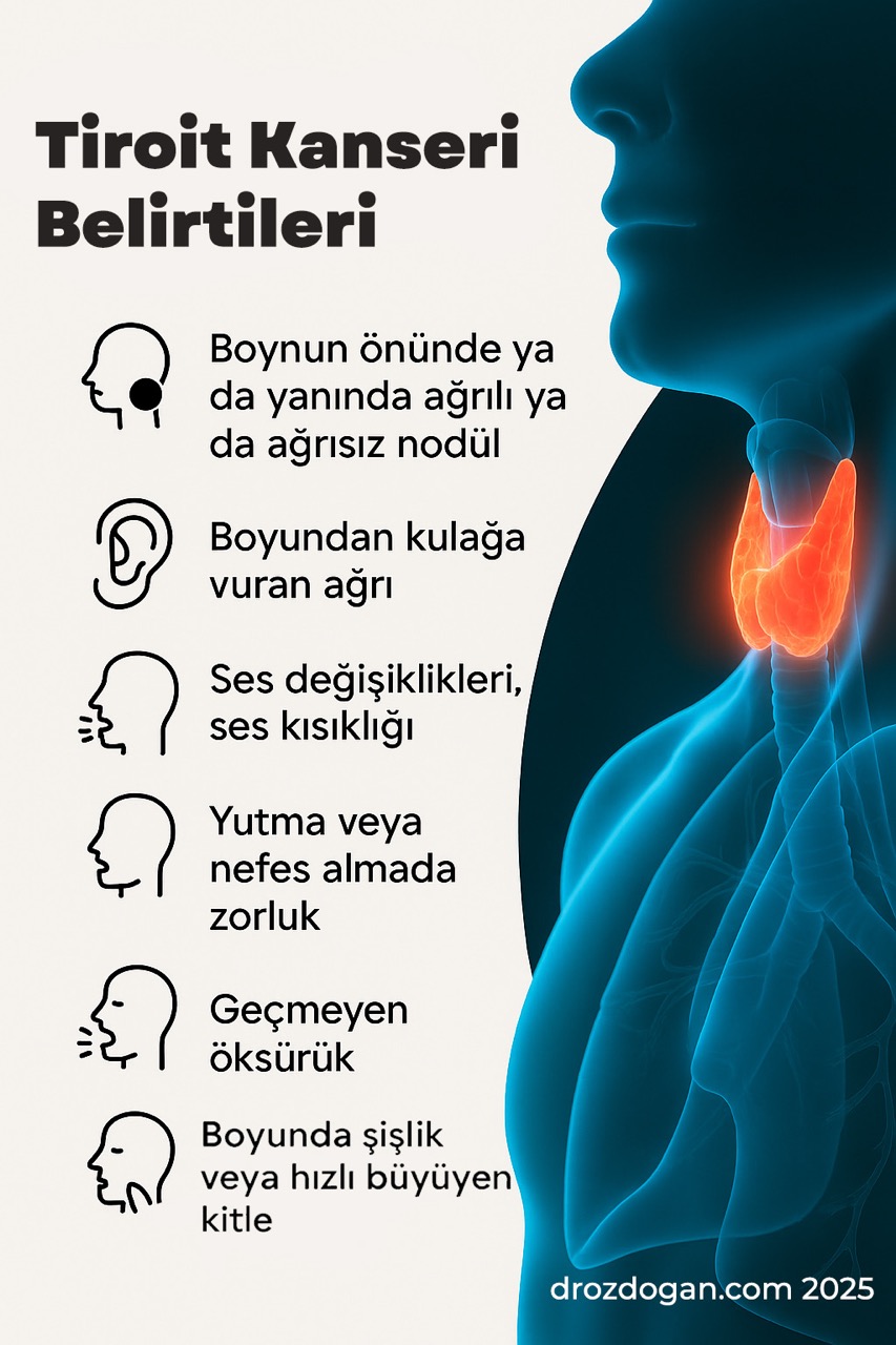 Simptomele cancerului tiroidian
